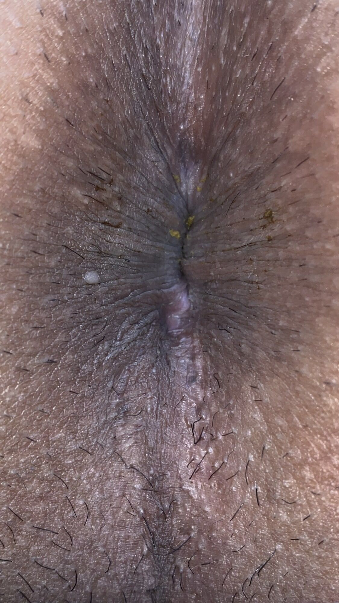 An image of my anus that is clear to every single wrinkle #12