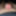 Close up foreskin and glans #6