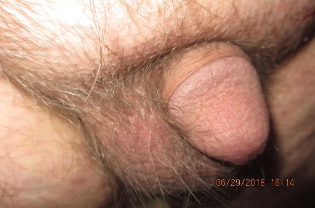 the evolution of a shrinking penis #6