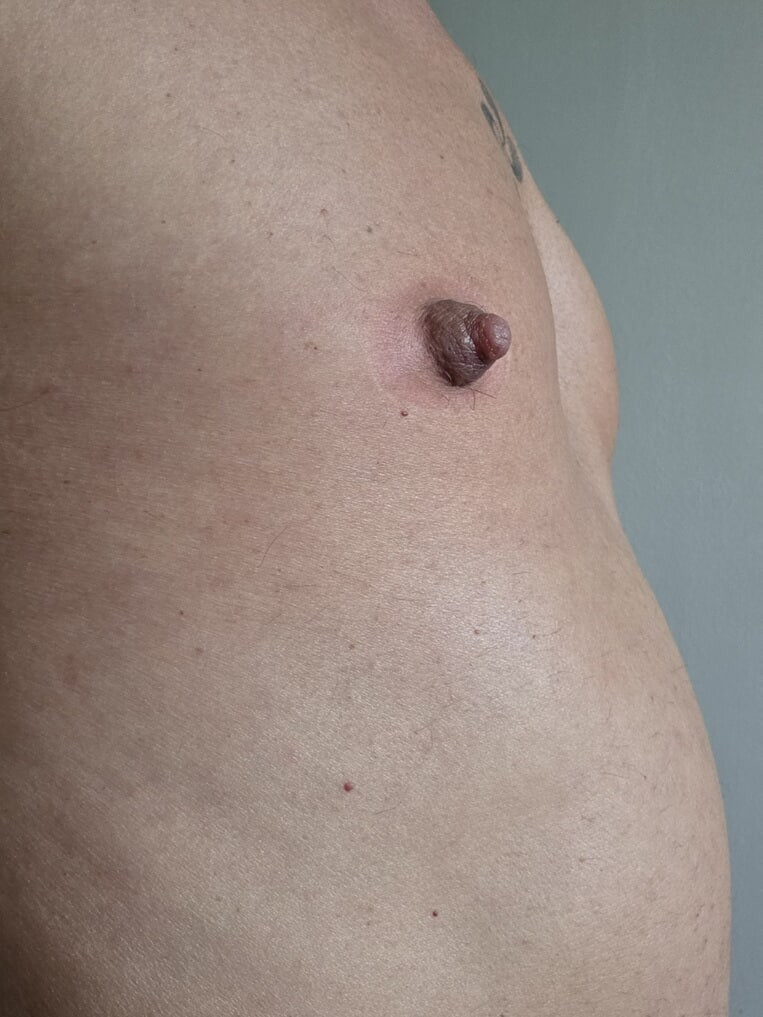 NIPPLES PUMPED 5 #14