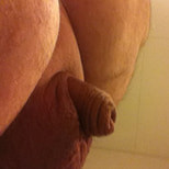 Micropenis #12