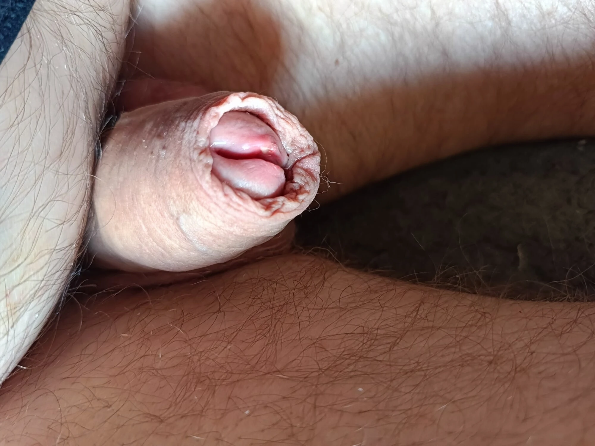penis