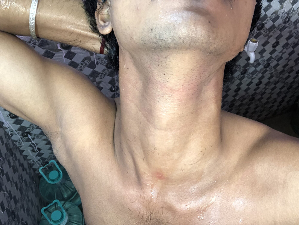 Pics of my slim  body  #10