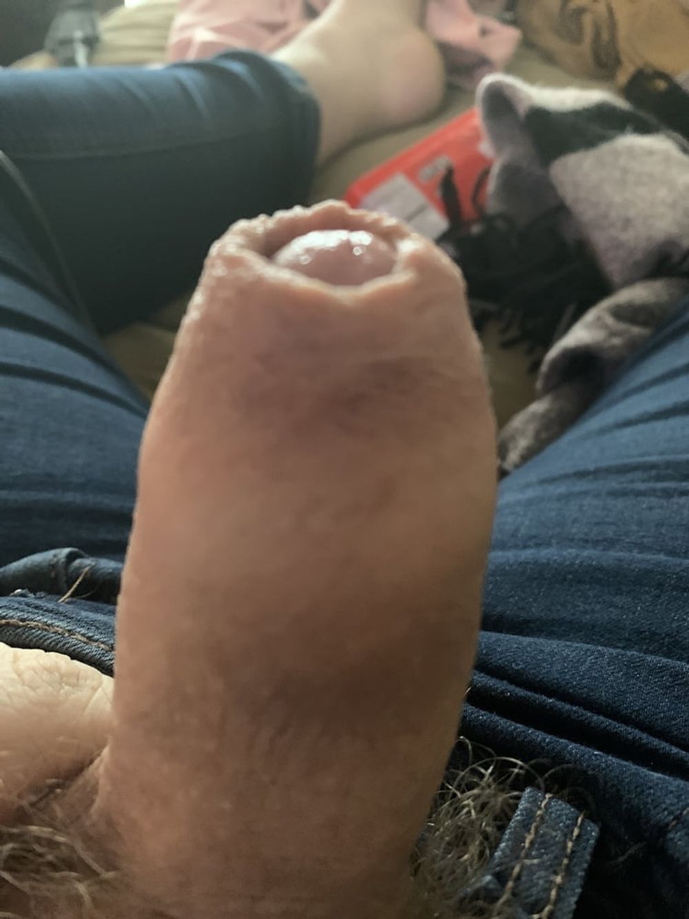 My foreskin #3