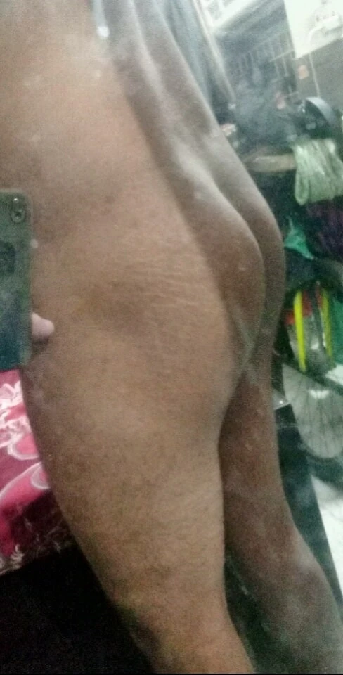 Big butt