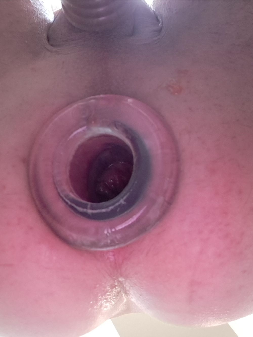 Gape