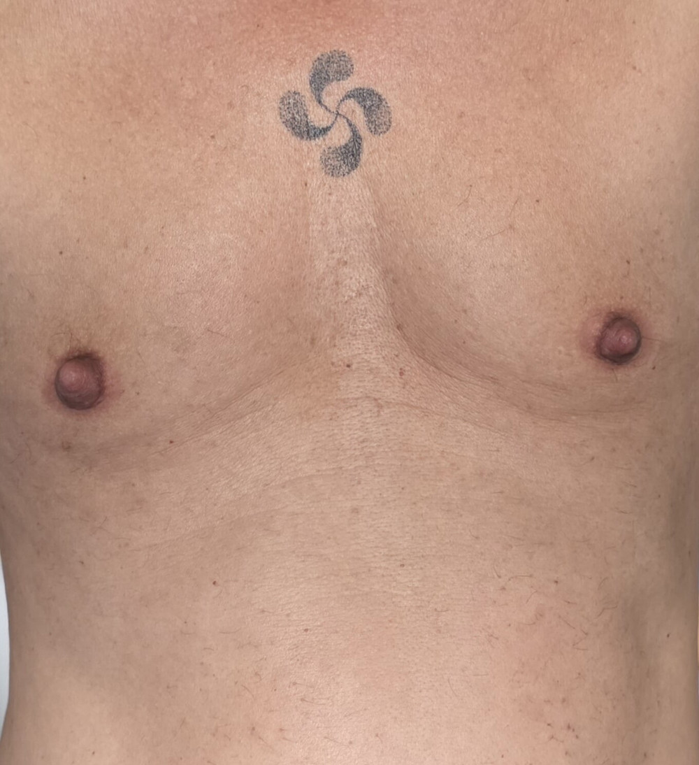 NIPPLES PUMPED 5 #23