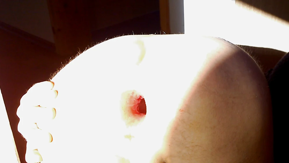 Big gaping asshole in extreme light #4