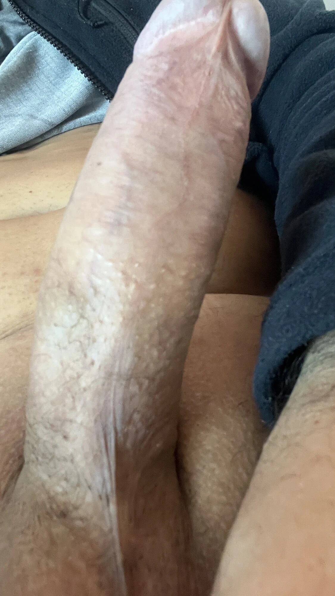 Penis 