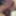 My penis before tugging 2025 #3