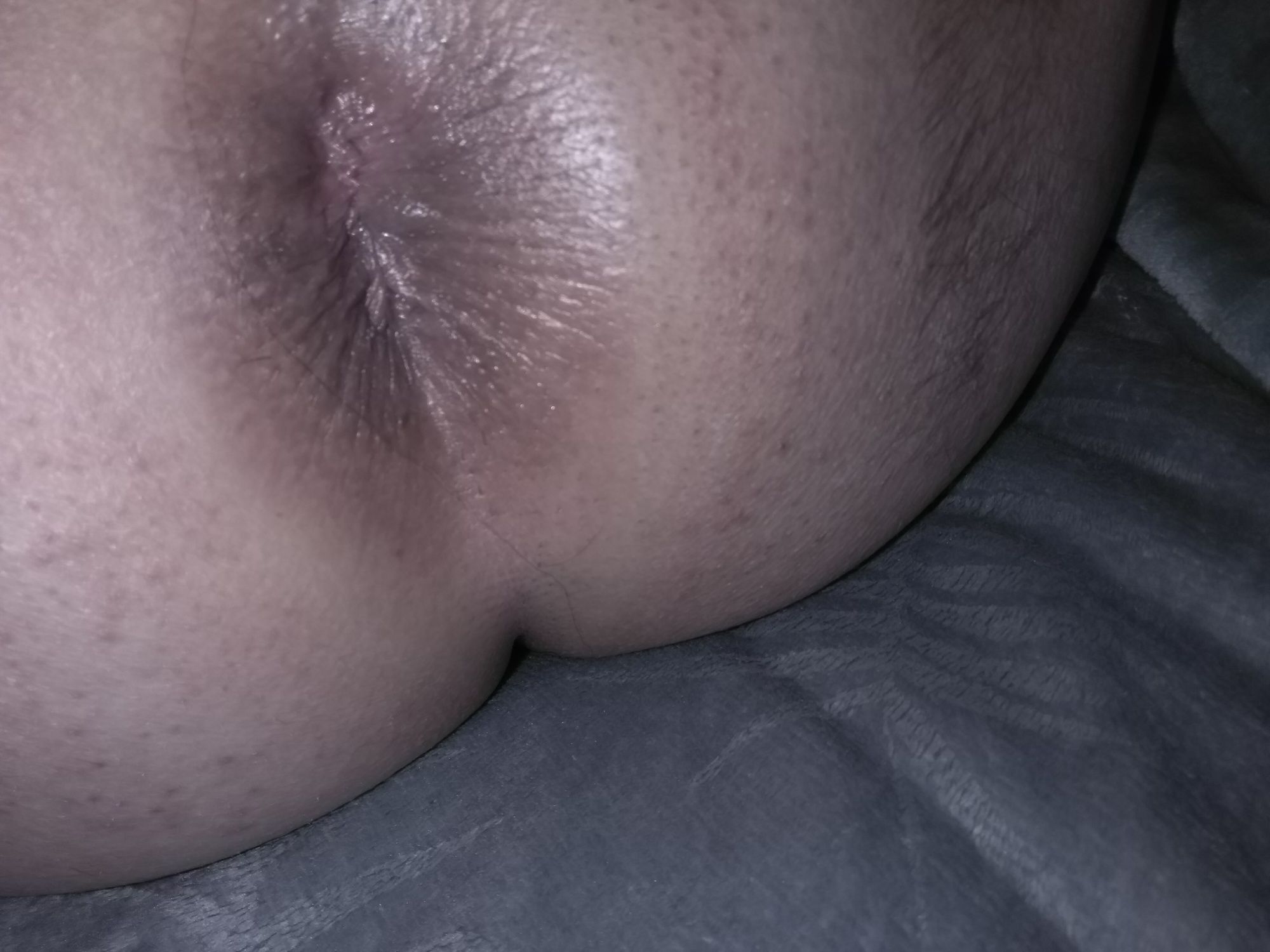 Ass #36