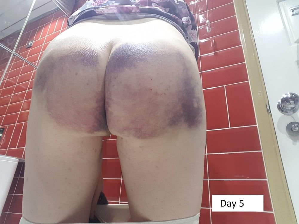 Spanking by Mistress Jenny Bruised Ass for over 7 days #14