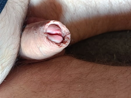 penis