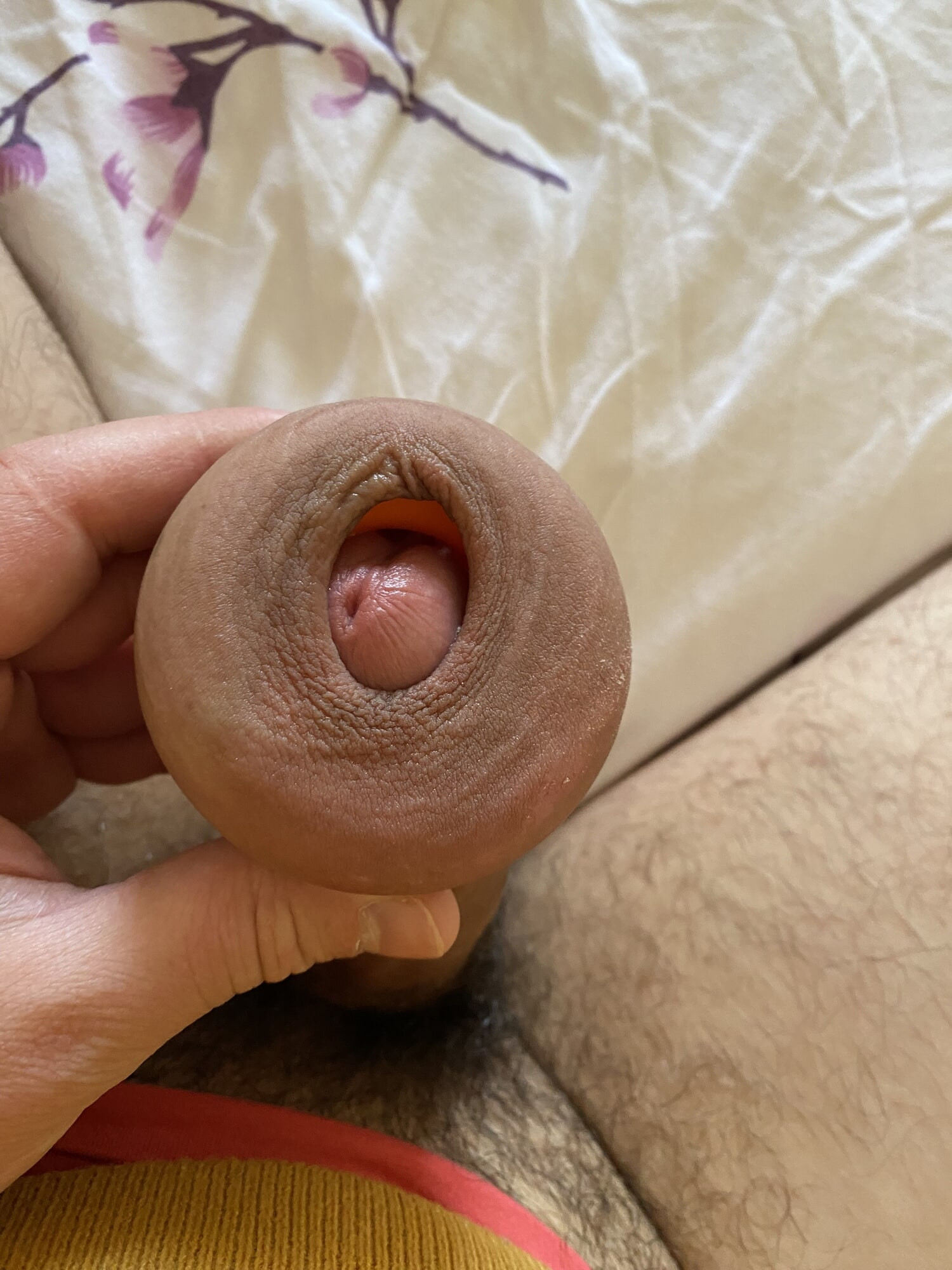 Extreme stretching foreskin #2