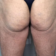 My Ass
