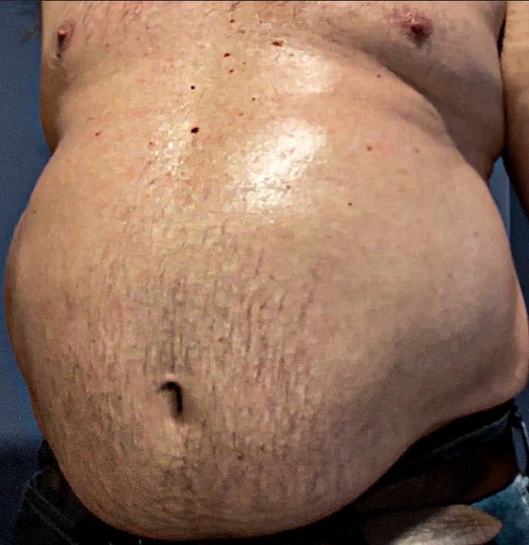 Ximd9000 Big Bloated Belly #2