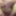 Fingering subincision deep #5