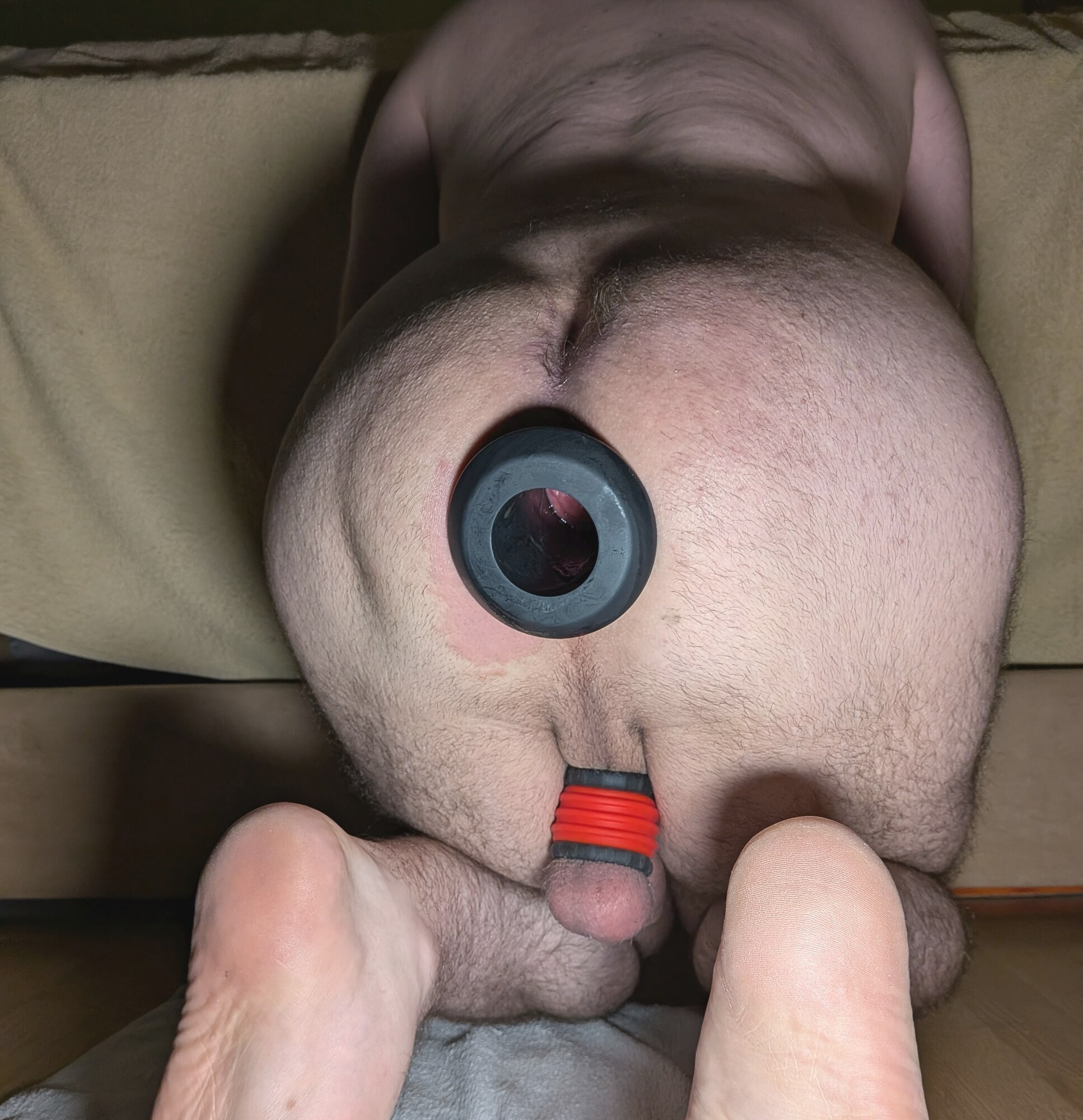 Pulling out large anal tunnel after 15 mins