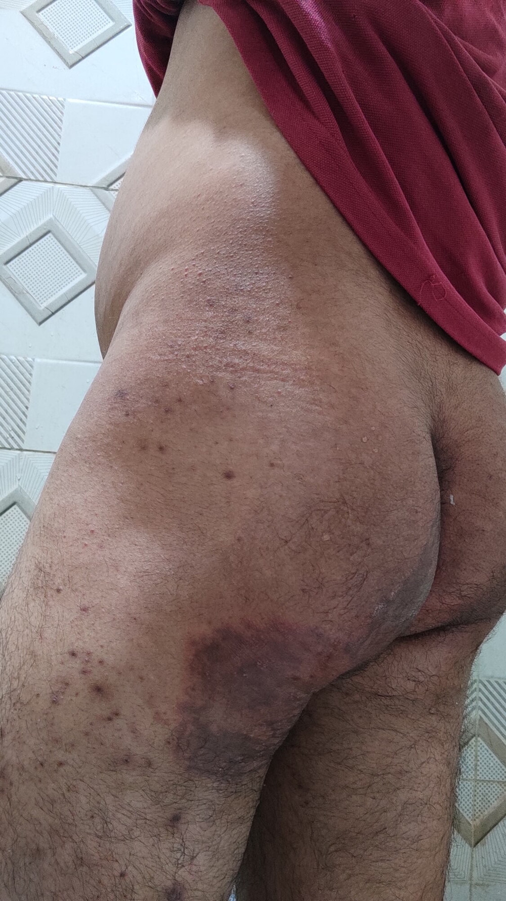 My Ass  #25