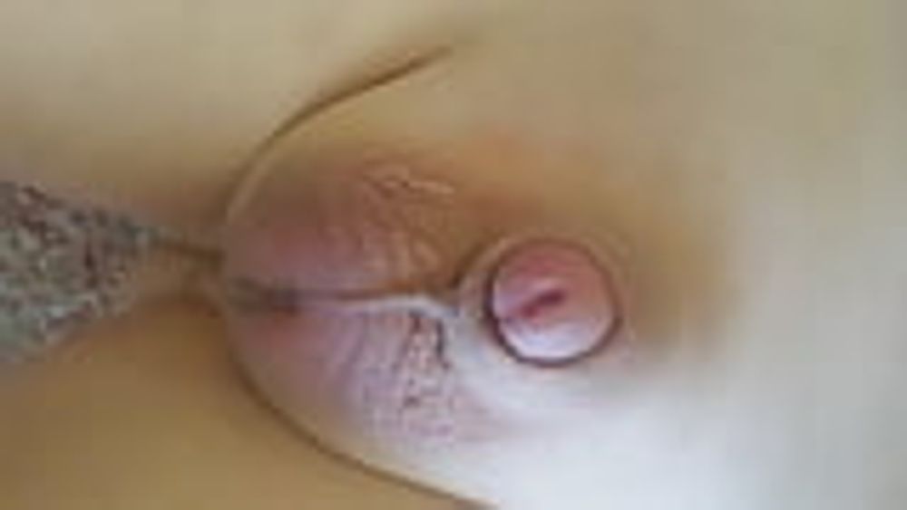 Tiny Cock Micropenis Small Dick #39