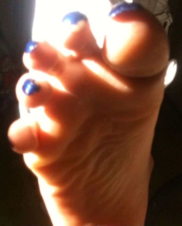 Blue toenails under sun ray #25
