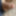 Long and loose foreskin #2
