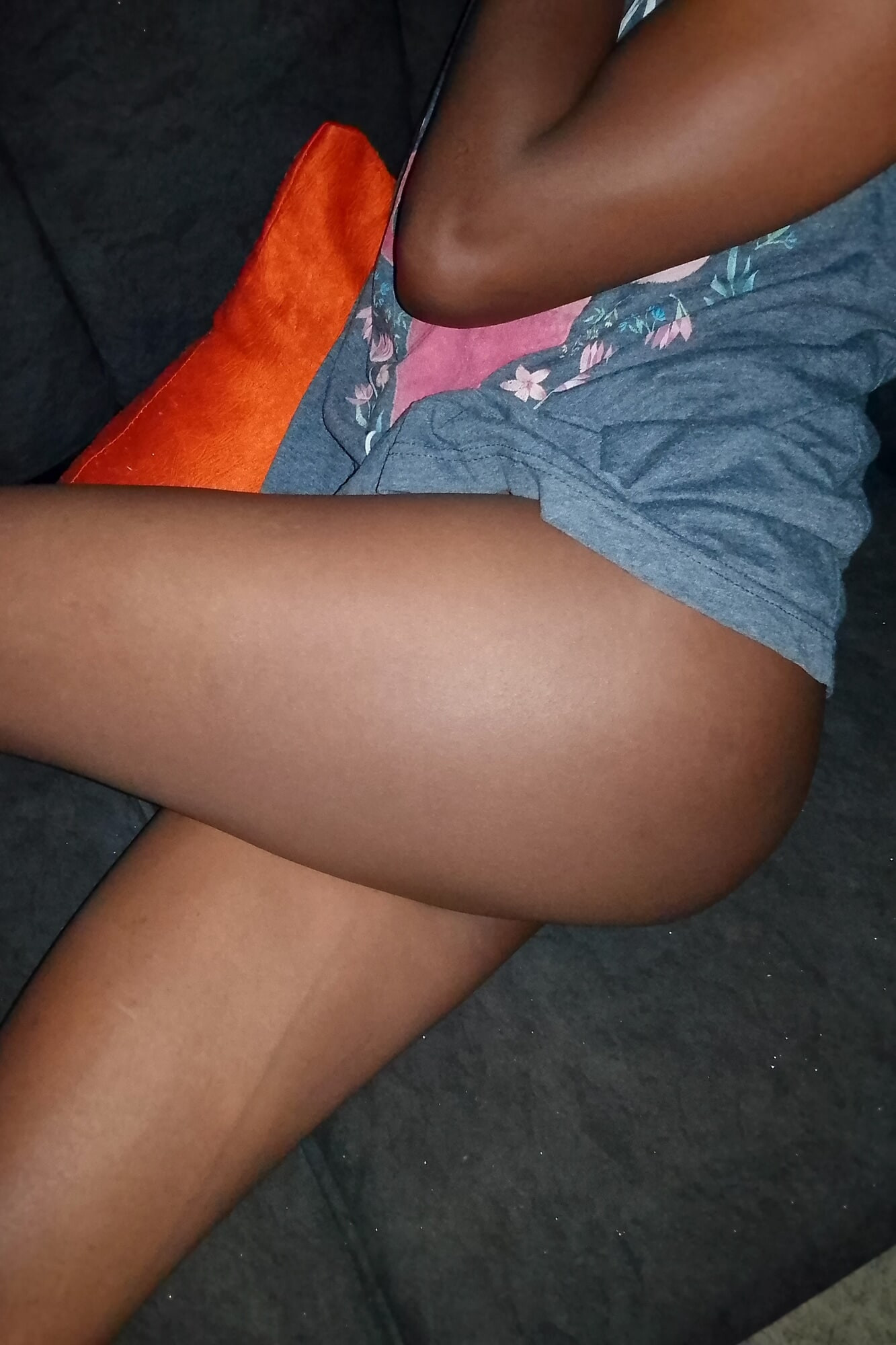 Cheeks too Dimplish #6