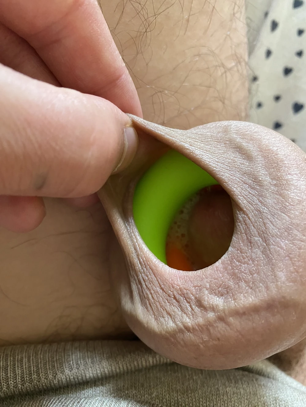 Foreskin stretching ring porn #5