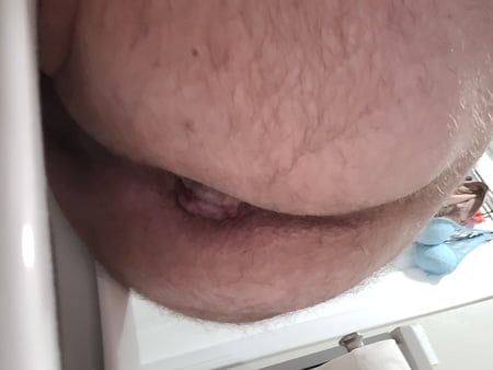 Asshole butt photos 