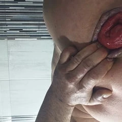 Anal fisting