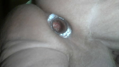 Anal Opening Dilator