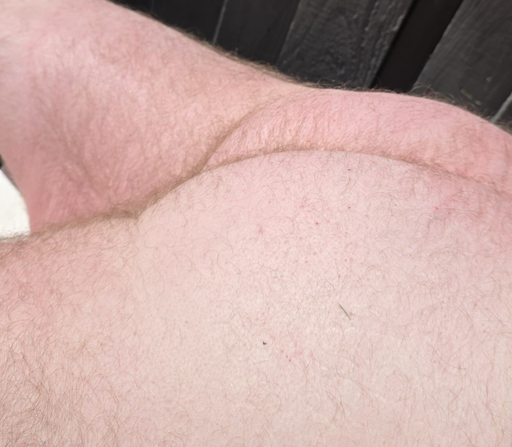 Sunbathing #2