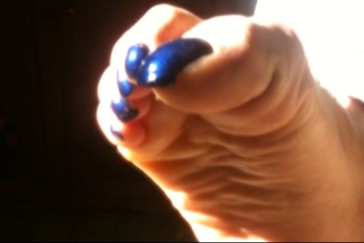 Blue toenails under sun ray #18