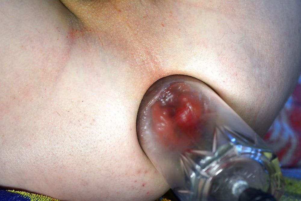 extreme prolapse pumping #54