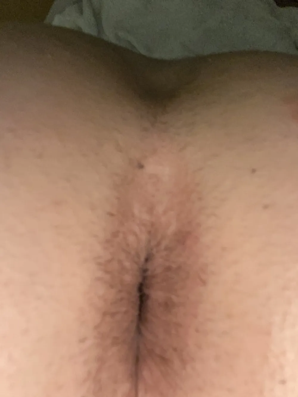 My gaped hole #2