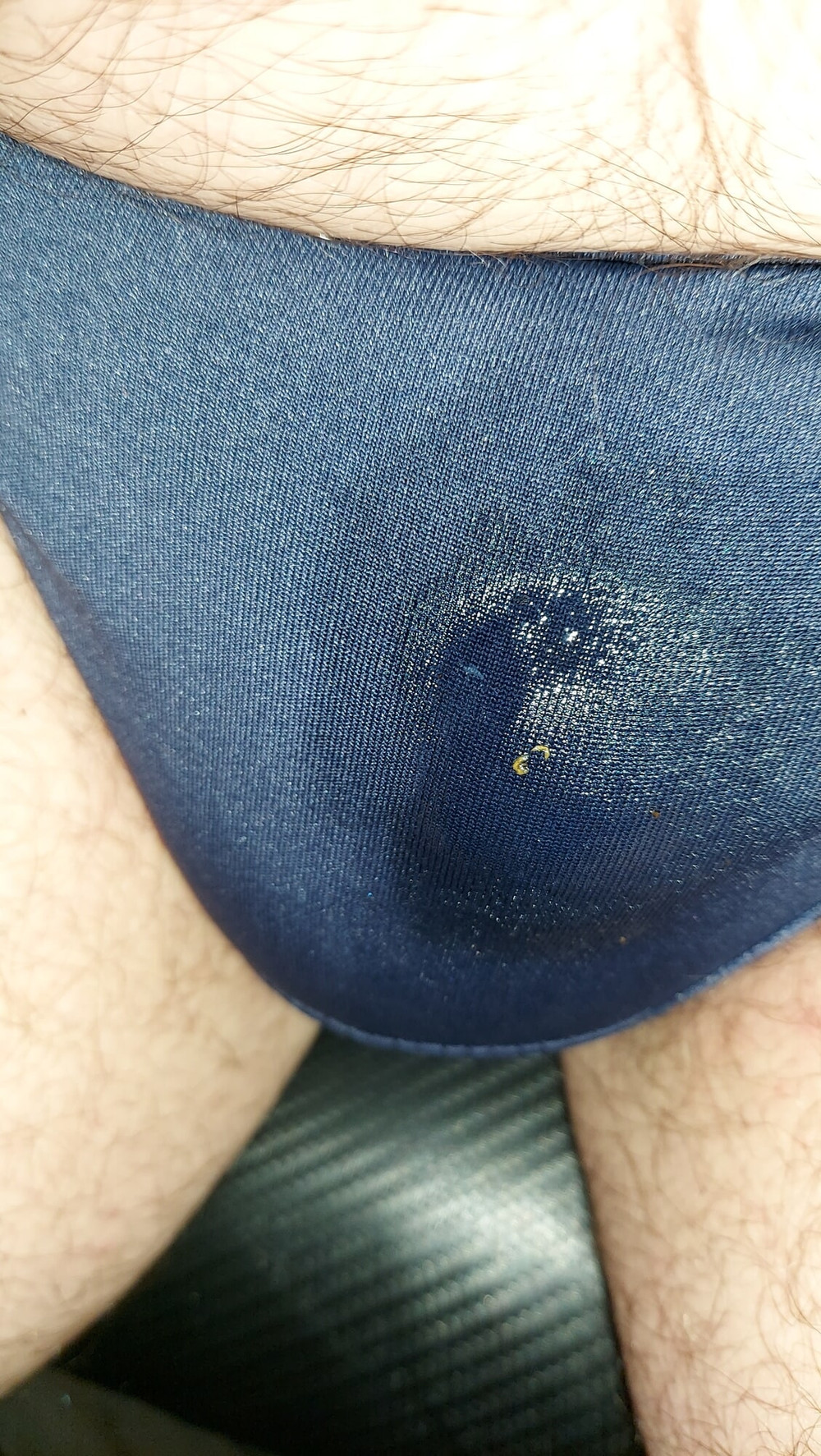 ich #6