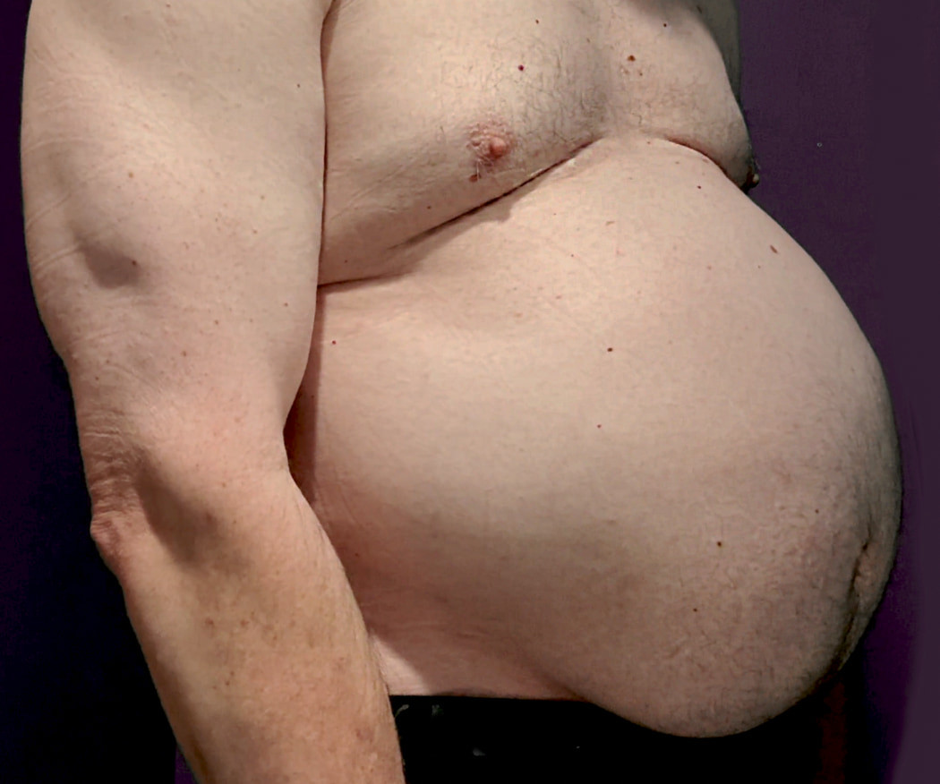 Ximd9000 Big Bloated Belly