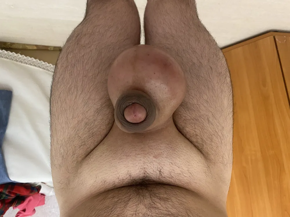 Balls inflation #31