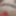 Teasers