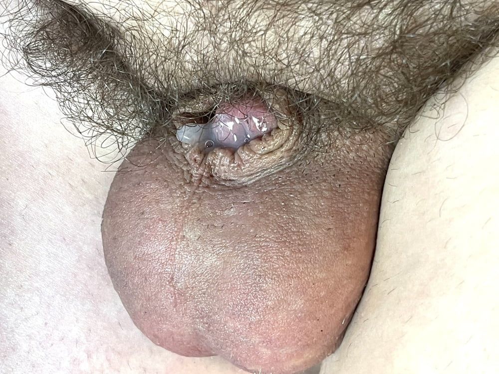 Micro cock, tiny penis pictures #22