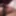 My circumcised penis new pics