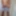 Heute kommen die Nachher Bilder (Rasieren)