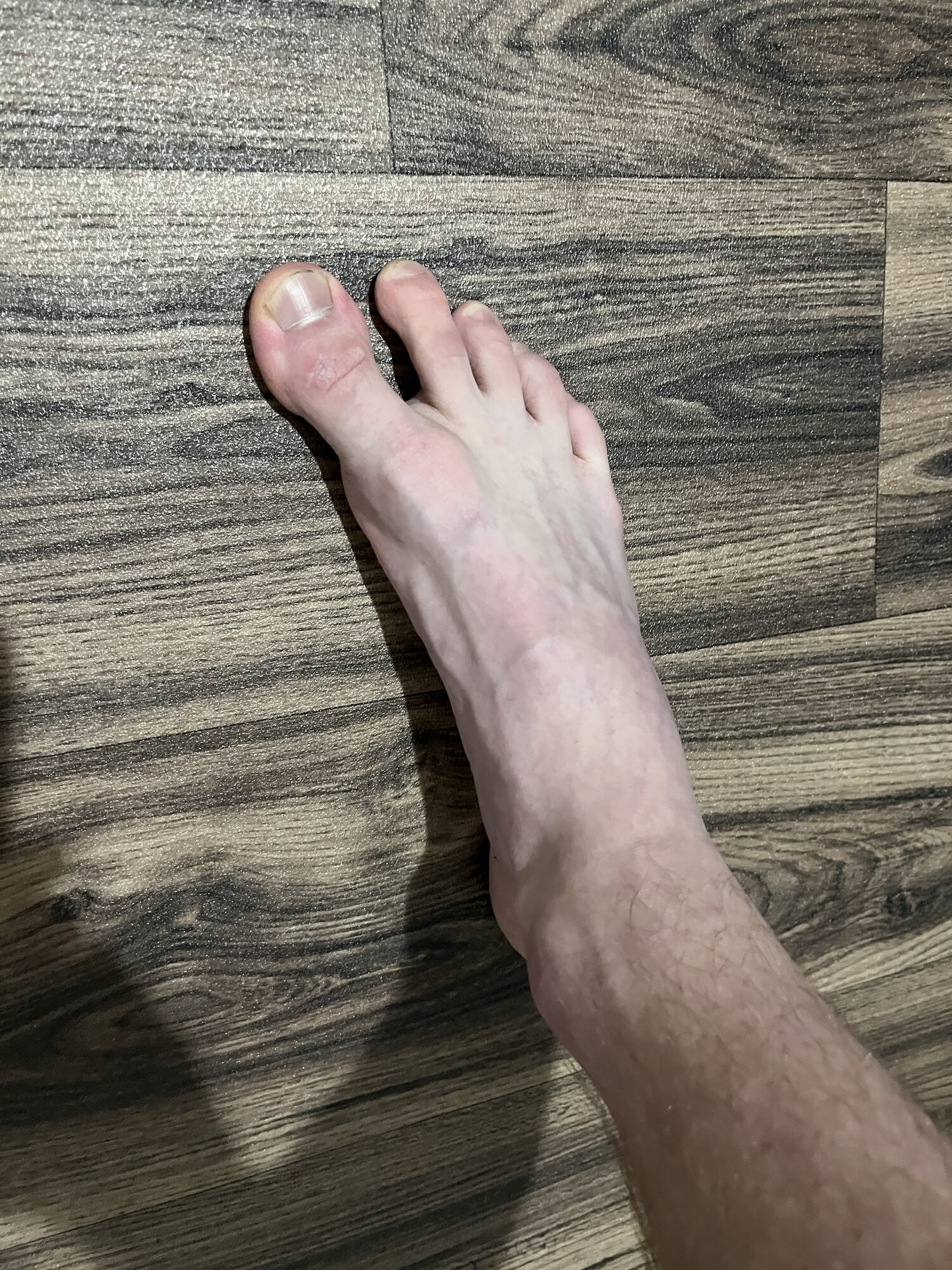 My feet #27