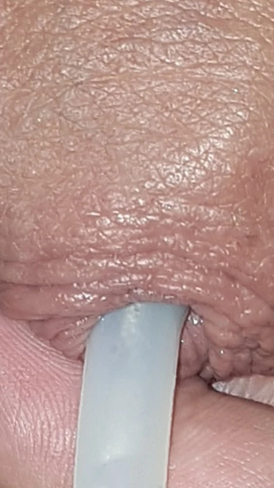 Urethral insertion #2