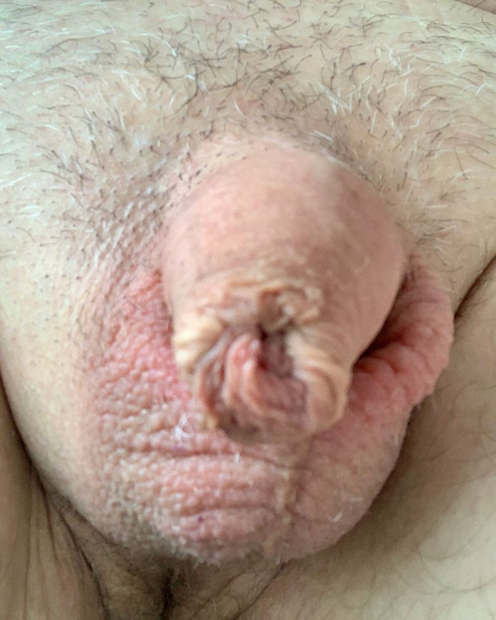 My small penis