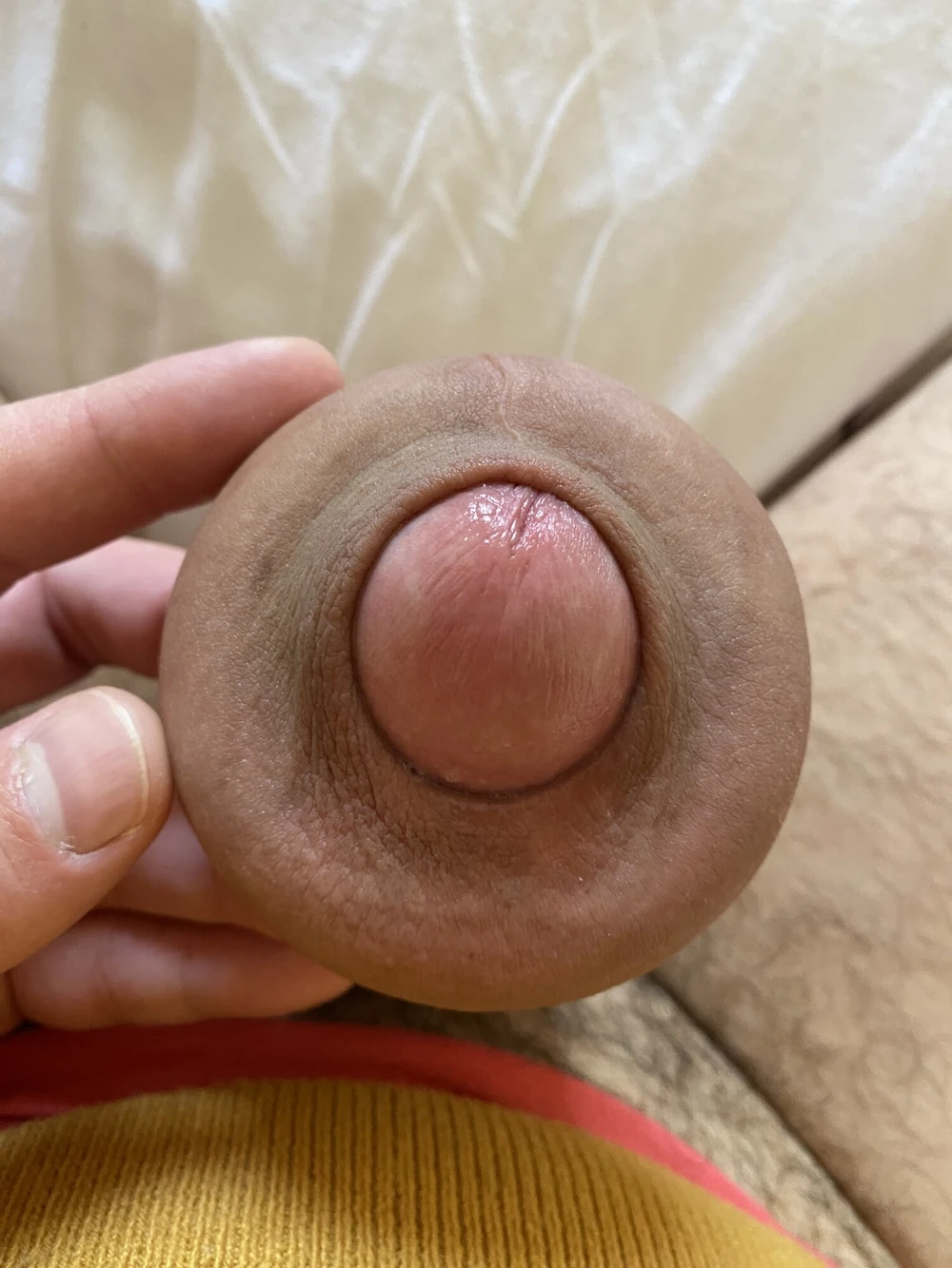 Extreme stretching foreskin #3