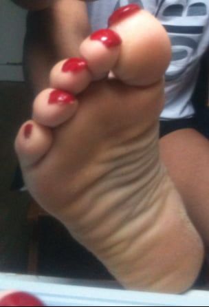 Asian ts feets, soles, toenails mix #30