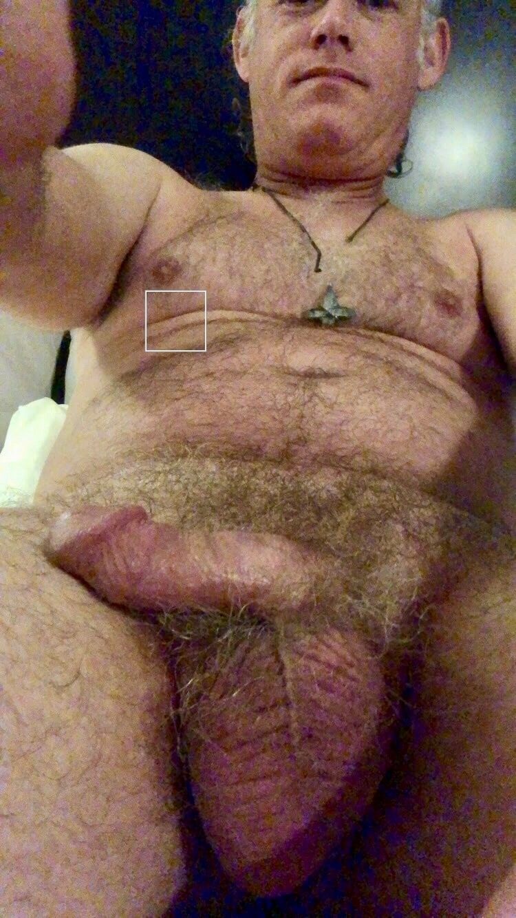 Hairy pic