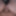 tiny phimosis foreskin dick 