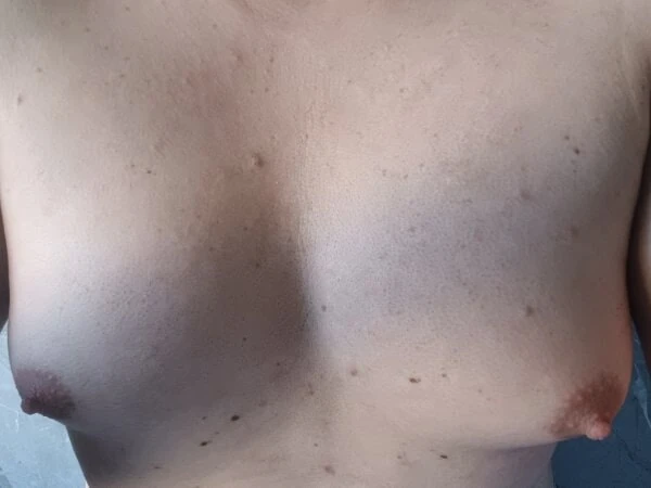 My breast
